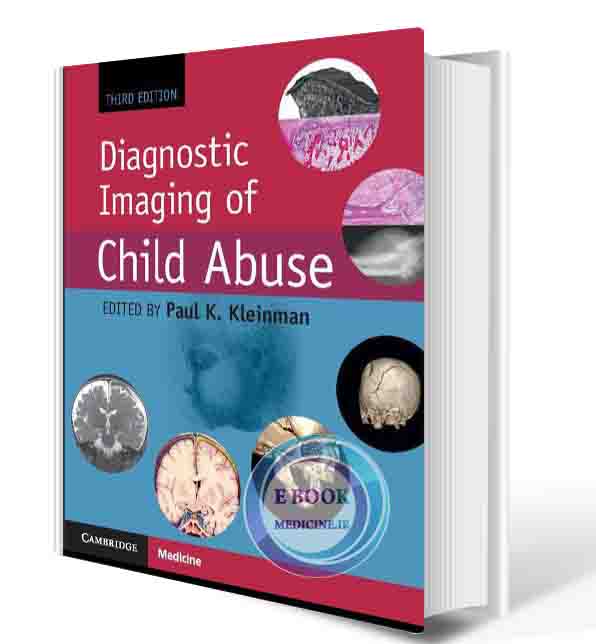 دانلود کتاب Diagnostic Imaging of Child Abuse 3rd  (ORIGINAL PDF)